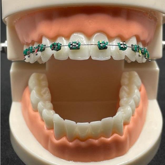 Ortho Legation Tool Decoration for Cosplay Smile, Braces - Cosplay Smile